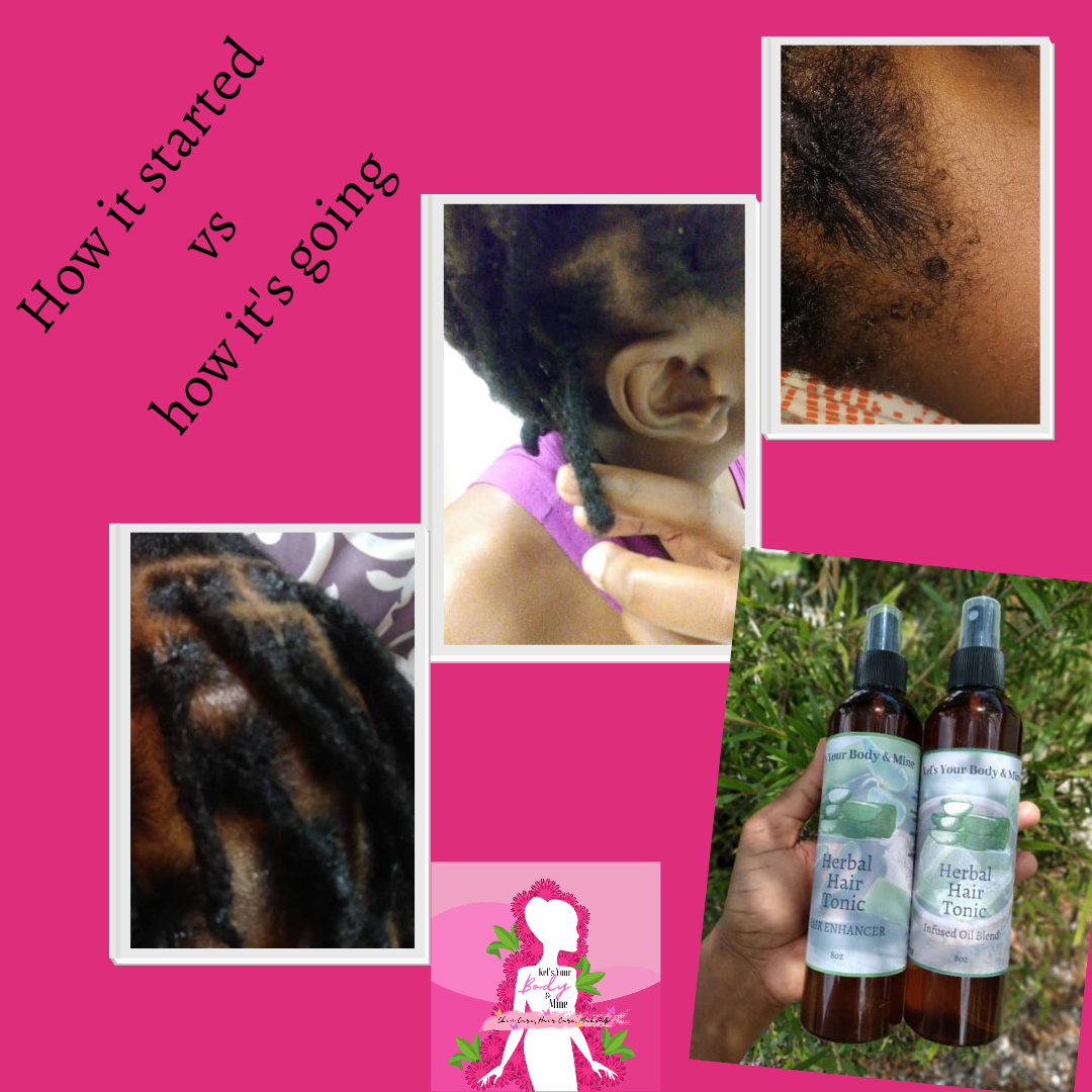 Herbal Hair Tonic